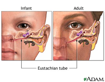 Otite infantile fisioterapia bambino roma